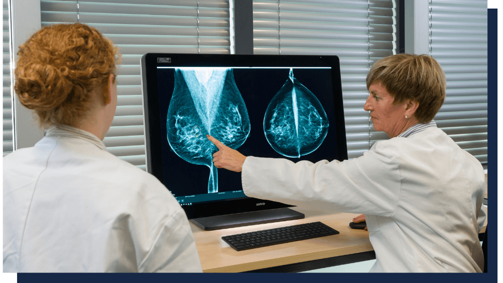 News & Events - ScreenPoint Medical
