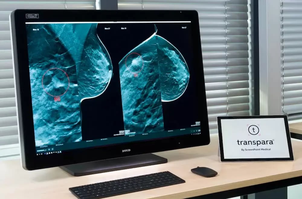 SPM Mamography Screens